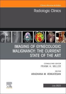 portada Imaging of Gynecologic Malignancy: The Current State of the Art, an Issue of Radiologic Clinics of North America (Volume 61-4) (The Clinics: Radiology, Volume 61-4) (en Inglés)