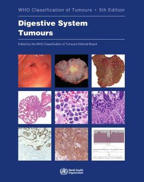 portada Digestive System Tumours (medicine) (en Inglés)