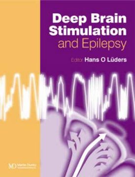 portada Deep Brain Stimulation and Epilepsy