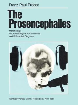 portada the prosencephalies: morphology, neuroradiological appearances and differential diagnosis (en Inglés)