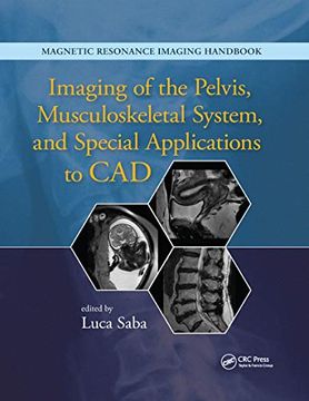 portada Imaging of the Pelvis, Musculoskeletal System, and Special Applications to cad (en Inglés)