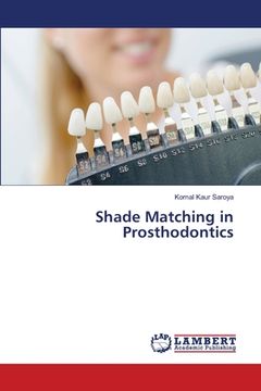 portada Shade Matching in Prosthodontics