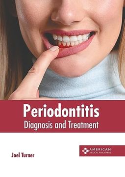 portada Periodontitis: Diagnosis and Treatment (en Inglés)