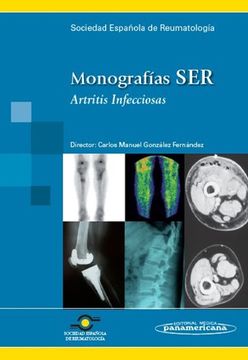 portada Monografía SER: Artritis infecciosa.