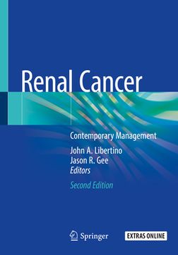 portada Renal Cancer: Contemporary Management (en Inglés)