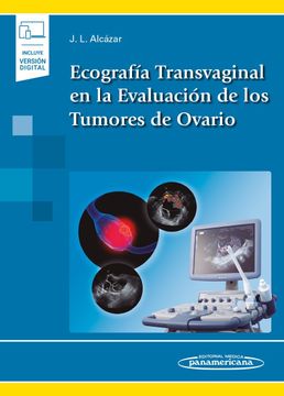 portada Ecografía Transvaginal en la Evaluación de los Tumores de Ovario (Incluye Versión Digital) (in Spanish)