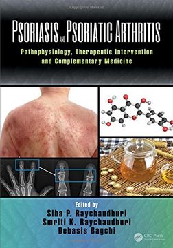 portada Psoriasis and Psoriatic Arthritis: Pathophysiology, Therapeutic Intervention, and Complementary Medicine (in English)