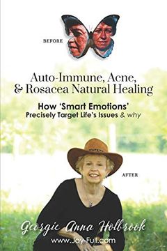 portada Auto-Immune, Acne, & Rosacea Natural Healing - how 'smart Emotions' Precisely Target Life's Issues & why (en Inglés)