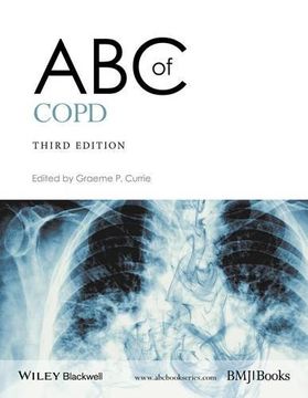 portada ABC of COPD (ABC Series)