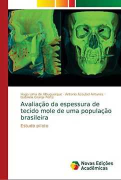 portada Avaliação da Espessura de Tecido Mole de uma População Brasileira: Estudo Piloto