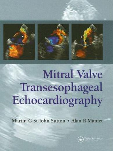 mitral valve transesophageal echocardiography