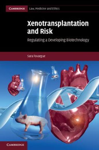 xenotransplantation and risk (en Inglés)