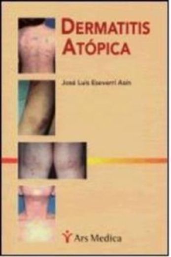Dermatitis Atopica (in Spanish)
