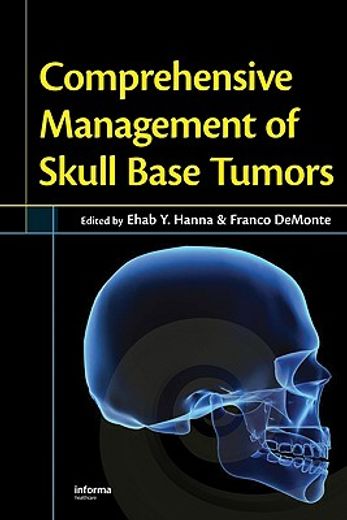 comprehensive management of skull base tumors