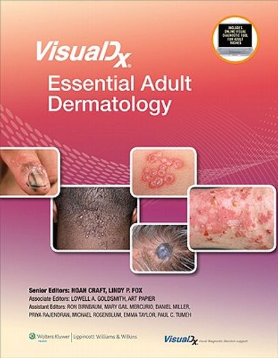 Visualdx: Essential Adult Dermatology (en Inglés)