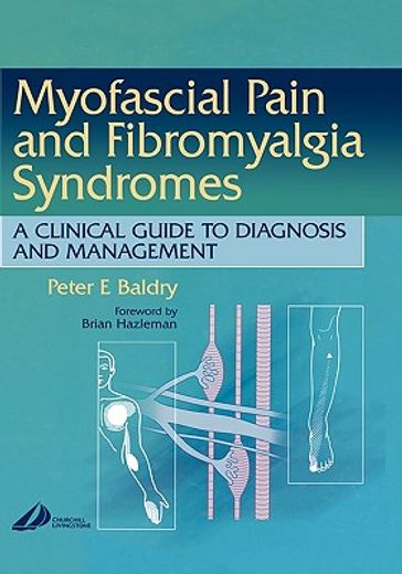 myofascial pain and fibromyalgia syndromes,a clinical guide to diagnosis and management