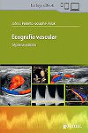 Ecografía Vascular (in Spanish)