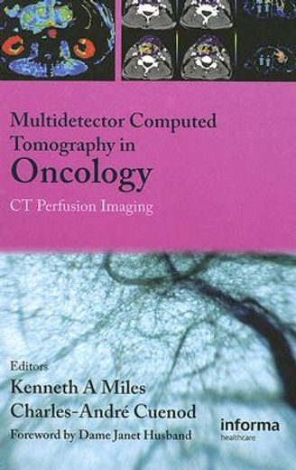 Multi-Detector Computed Tomography in Oncology: CT Perfusion Imaging (en Inglés)