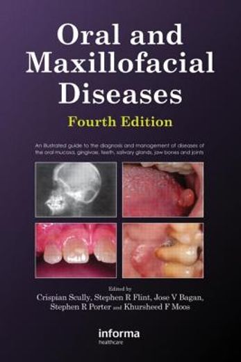 oral and maxillofacial diseases,an illustrated guide to the diagnosis and management of diseases of the oral mucosa, gingivae, teeth