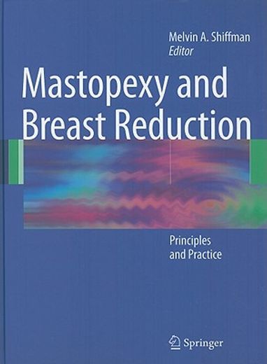 mastopexy and breast reduction,principles and practice (en Inglés)