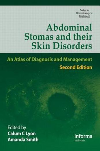 Abdominal Stomas and Their Skin Disorders (en Inglés)