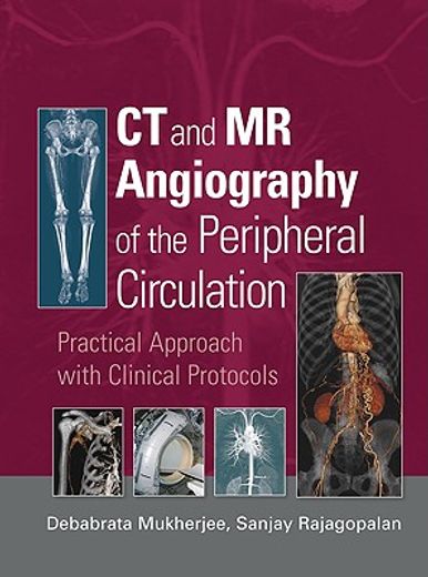 CT and MR Angiography of the Peripheral Circulation: Practical Approach with Clinical Protocols (en Inglés)