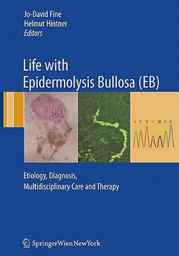 life with epidermolysis bullosa (eb),etiology, diagnosis, multidisciplinary care and therapy (en Inglés)
