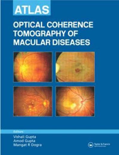Atlas of Optical Coherence Tomography of Macular Diseases (en Inglés)