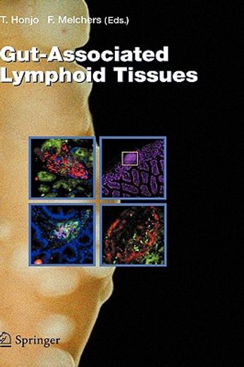 gut-associated lymphoid tissues