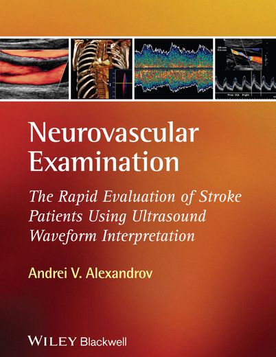 neurovascular examination: the rapid evaluation of stroke patients using ultrasound waveform interpretation