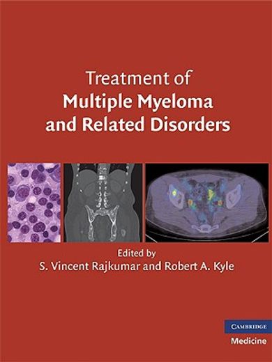treatment of multiple myeloma and related disorders (en Inglés)
