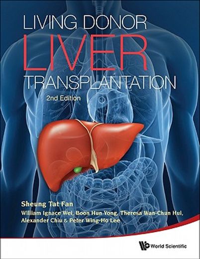Living Donor Liver Transplantation (2nd Edition) (en Inglés)