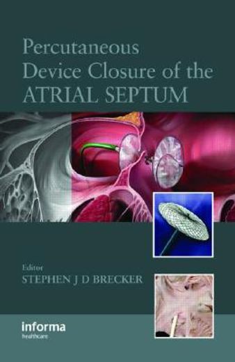 Percutaneous Device Closure of the Atrial Septum (en Inglés)