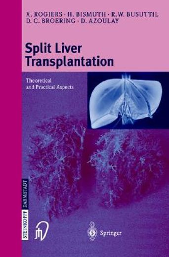 split liver transplantation,theoretical and practical aspects (in English)