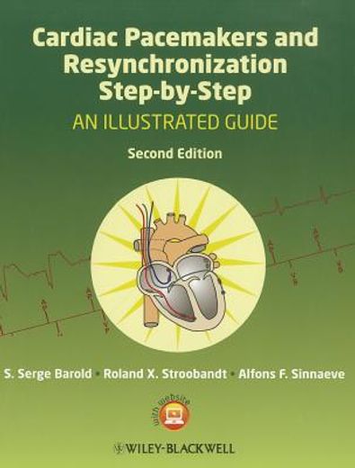 cardiac pacemakers and resynchronization step by step,an illustrated guide