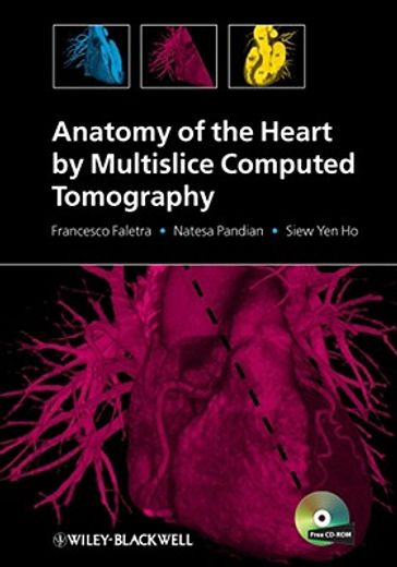Anatomy of the Heart by Multislice Computed Tomography [With CDROM] (en Inglés)