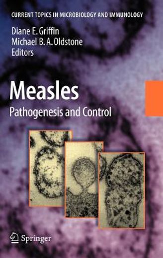 measles,pathogenesis and control