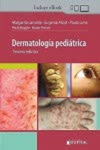 Dermatología Pediátrica (in Spanish)