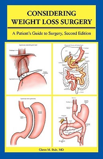 considering weight loss surgery,a patient´s guide to surgery