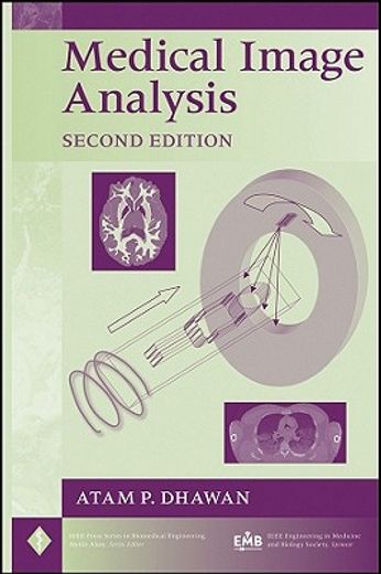 medical image analysis (en Inglés)
