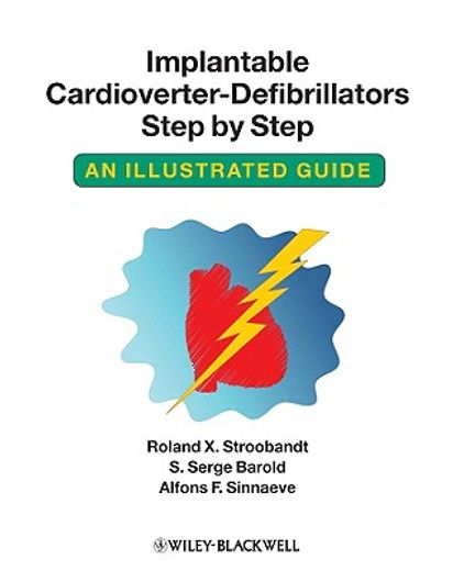 implantable cardioverter-defibrillators step by step,an illustrated guide