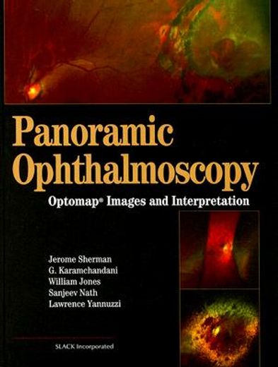 panoramic ophthalmosopy,optomap images and interpretation