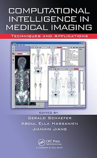 Computational Intelligence in Medical Imaging: Techniques and Applications (in English)