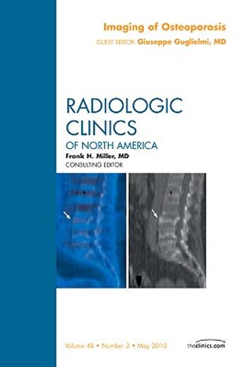 Imaging of Osteoporosis, an Issue of Radiologic Clinics of North America: Volume 48-3 (en Inglés)