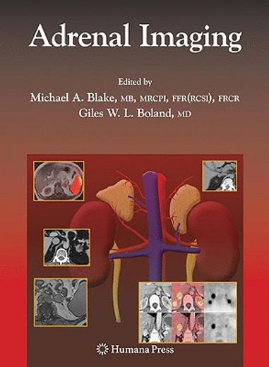 Adrenal Imaging (in English)