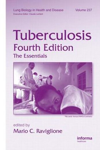 tuberculosis,the essentials