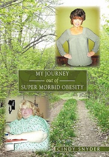 my journey out of super morbid obesity