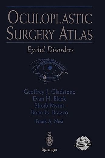 oculoplastic surgery atlas,eyelid disorders