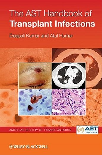 the ast handbook of transplant infections (en Inglés)
