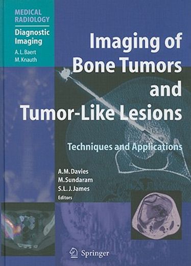 imaging bone tumors and tumor-like lesions,techniques and applications